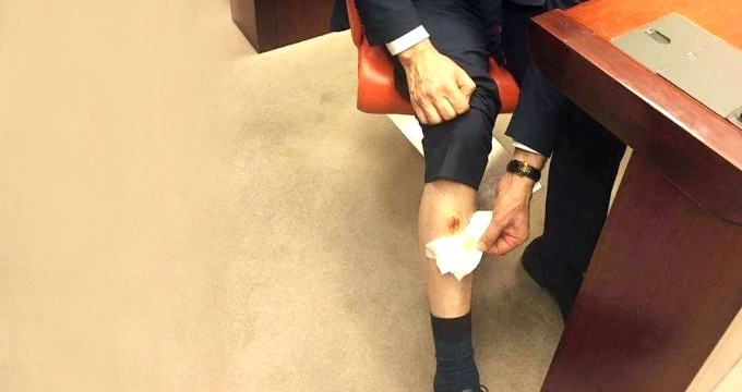 CHP Milletvekili, AK Partili Balta'yı Bacağından Isırdı